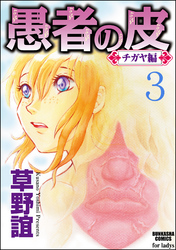 愚者の皮―チガヤ編―（分冊版）永訣　【第3話】